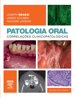 Livro: Patologia Oral - Regezi