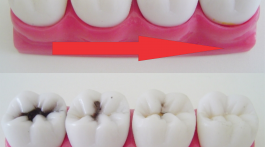Regeneração de tecido dentário