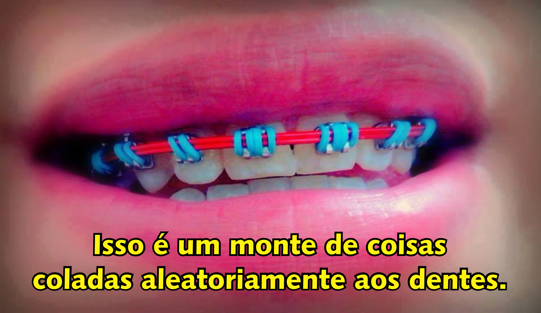 Dentista Minuto #57: O que faz um ortodontista